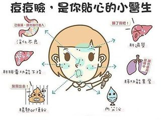 暴發性痤瘡生長機制