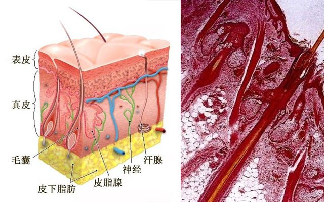 前胸后背長痘痘是什么原因