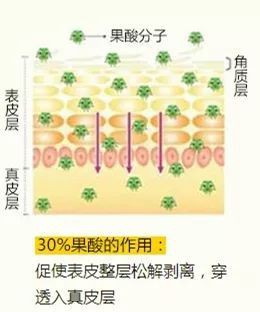 果酸祛痘的方法到底靠不靠譜？