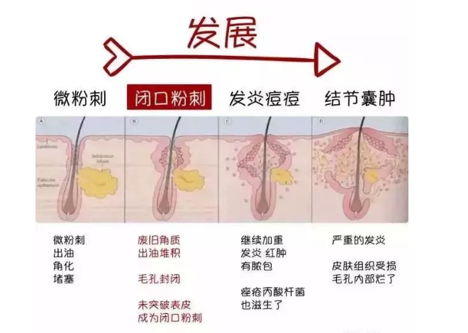 閉口怎么來的？反反復復怎么辦？？？